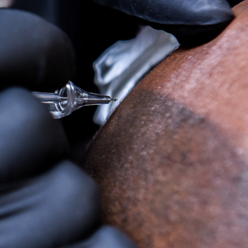 Understanding Hair Loss and How Scalp Micropigmentation Can Help